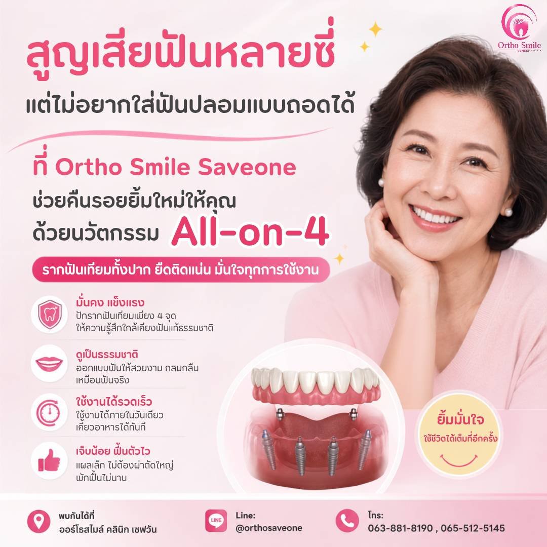 คืนรอยยิ้มใหม่ด้วยนวัตกรรม All-on-4
